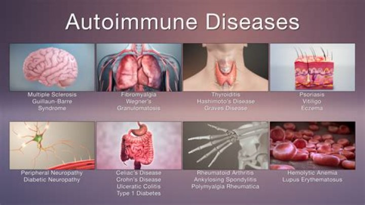 Are allergies an autoimmune disease?