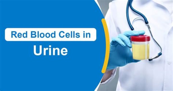 Are red blood cells in urine?