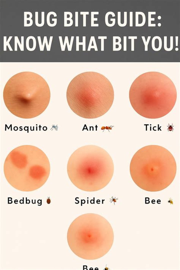 By bitten by the bug?