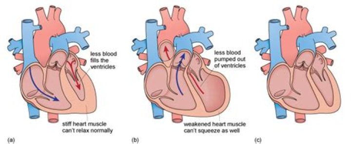 Can a weakened heart muscle be strengthened?