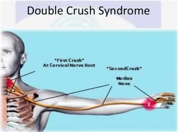 Can carpal tunnel cause shoulder pain?