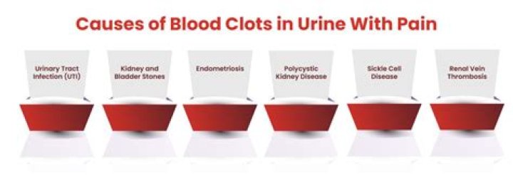 Can clots cause blood in urine?