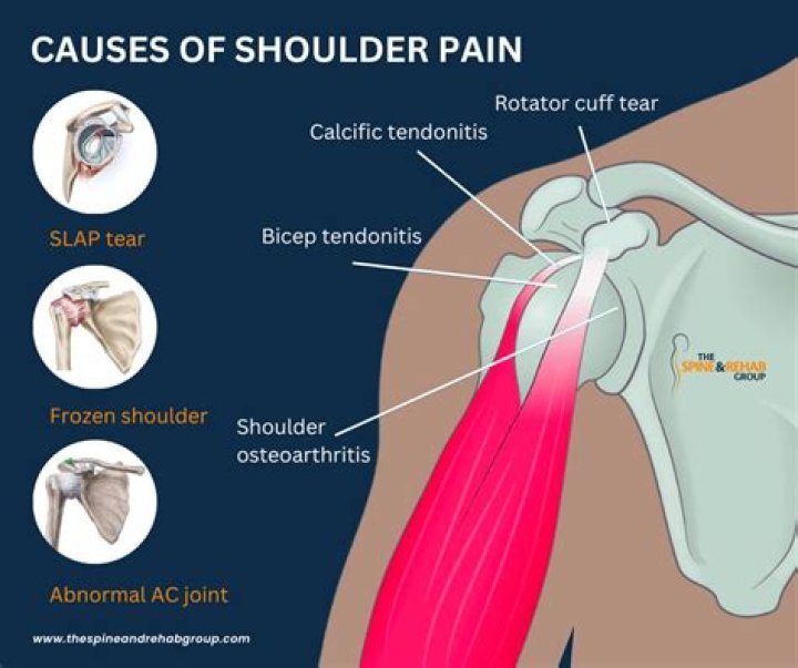 Can cts cause shoulder pain?