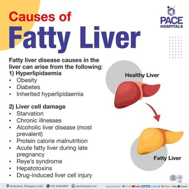 Can fatty liver be cured?