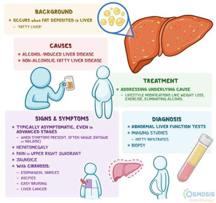 Can fatty liver mimicking metastatic disease?