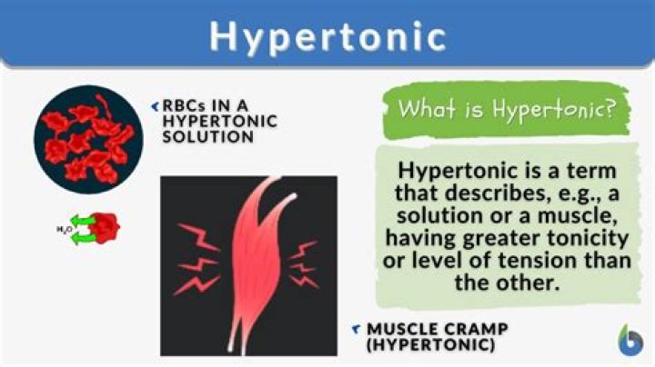 Can hypertonia be cured?