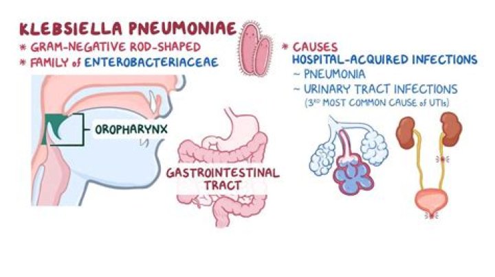 Can klebsiella pneumoniae cause uti?