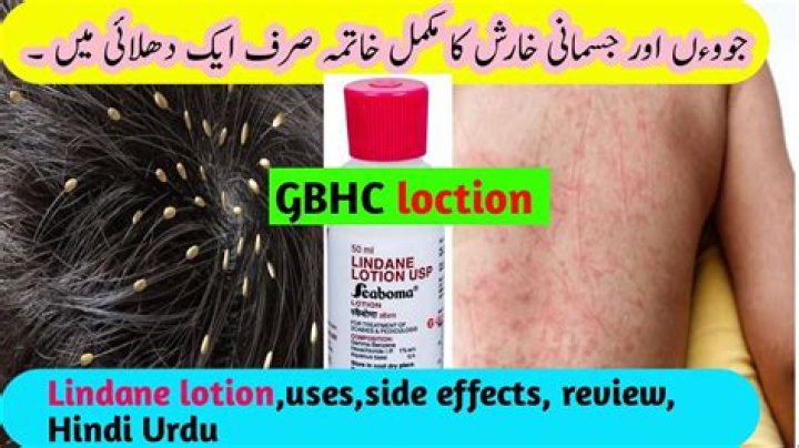Can lindane lotion be used on hair?