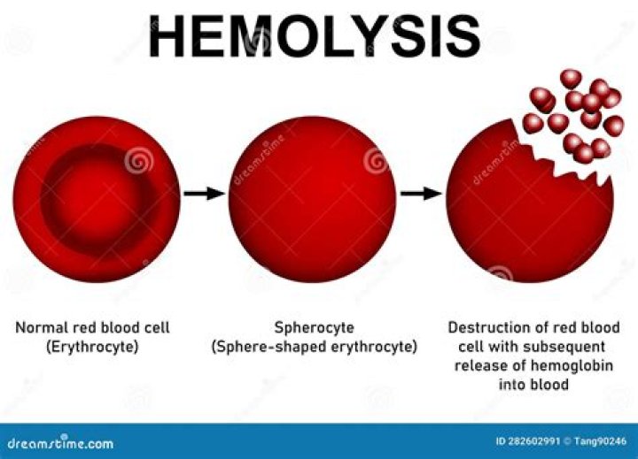 Can whole blood be hemolyzed?