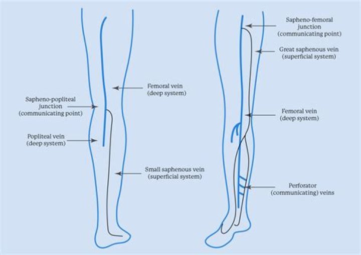 Can you live without saphenous vein?