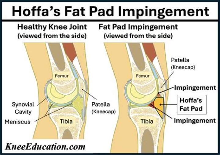 Did hoffa's son drive him to the house?
