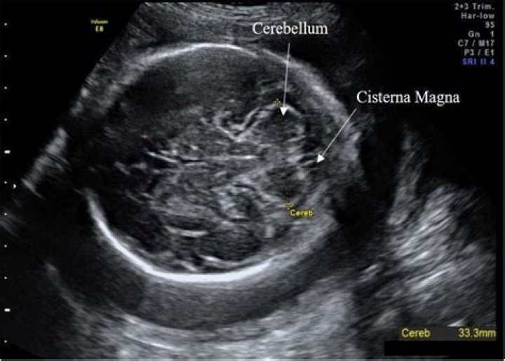 Do cats have a large cerebellum?