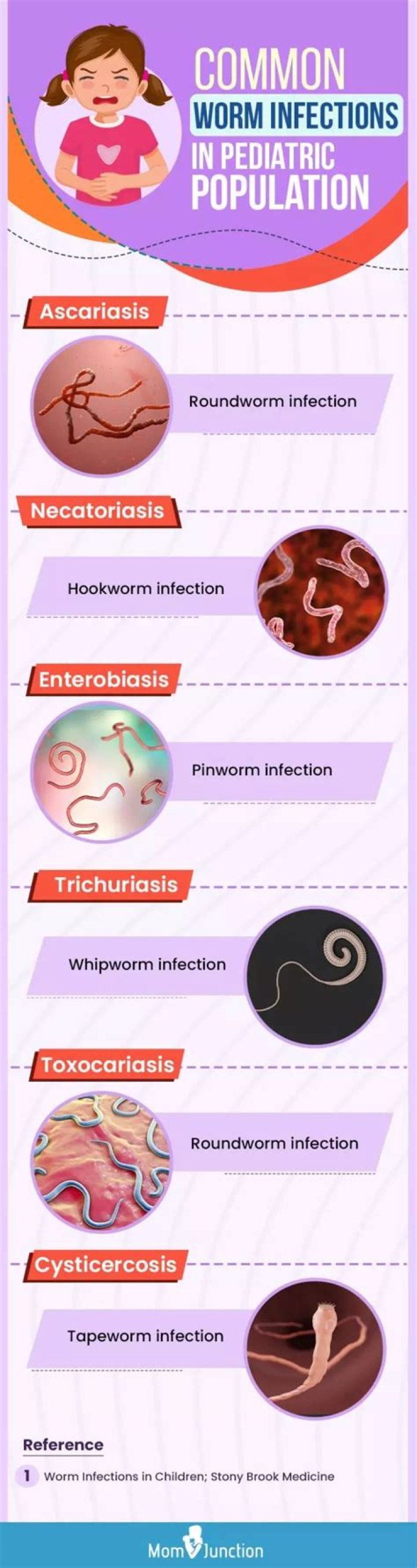 Do pinworms cause eosinophilia?