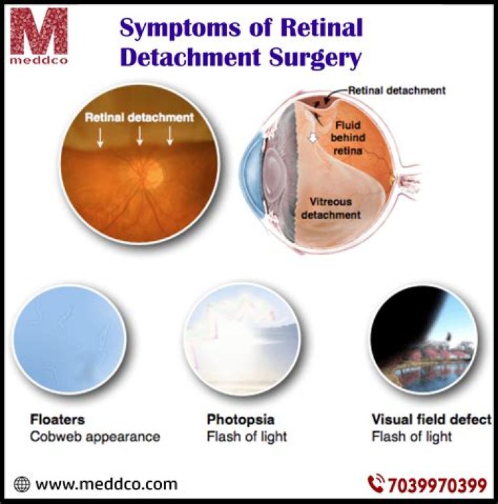 Do retinal detachment symptoms go away?