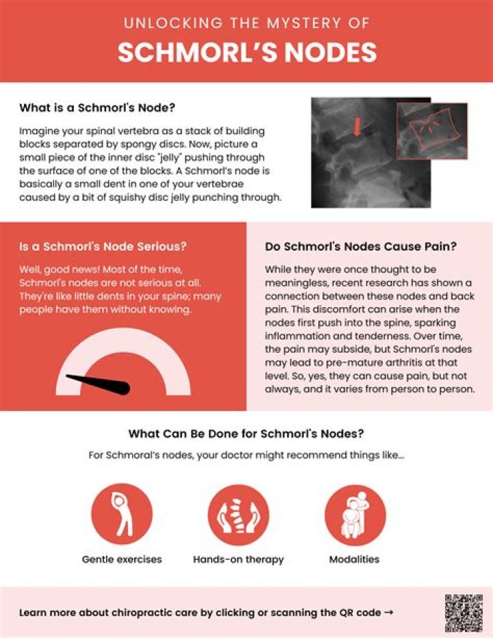 Do schmorl's nodes go away?