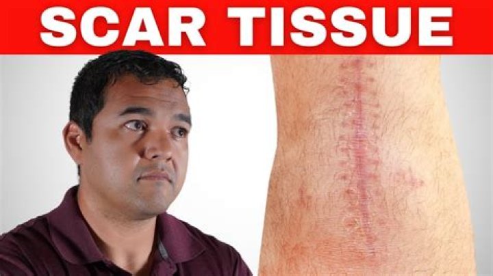 Do scraped knee scar?