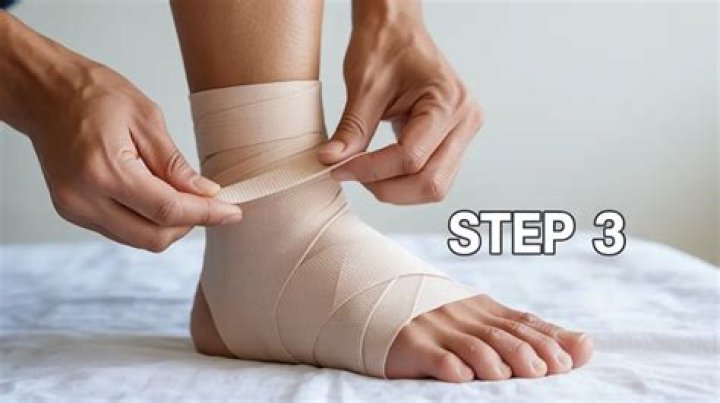Do tensor bandages reduce swelling?