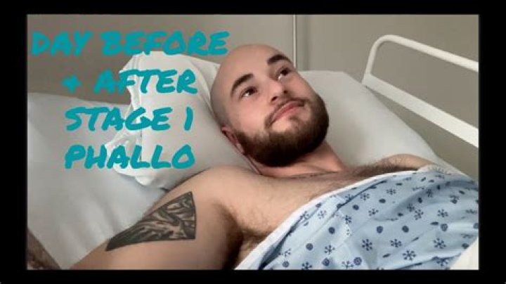 Do you have feeling after phalloplasty?