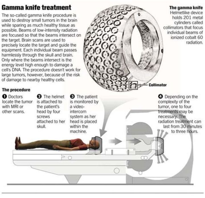 Does gamma knife cause hair loss?