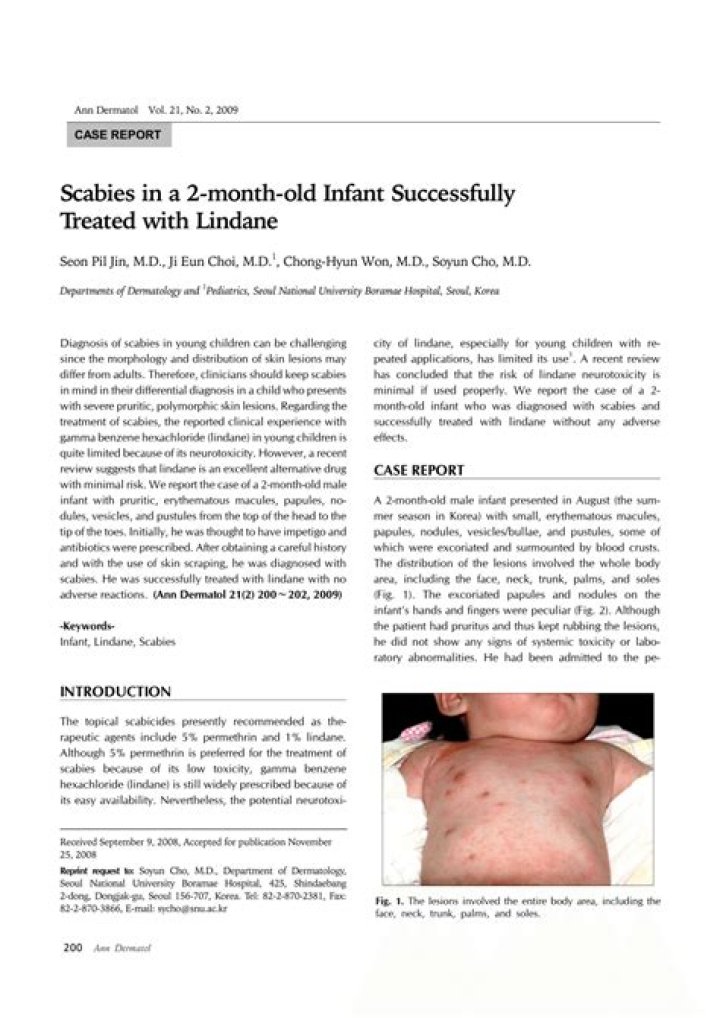 Does lindane work for scabies?