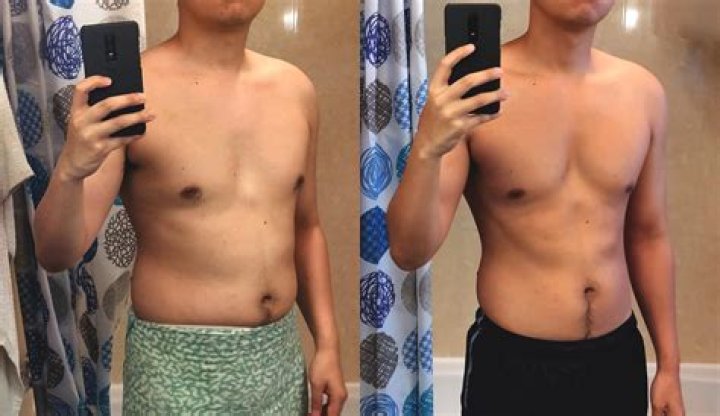 Does lithium cause weight gain?