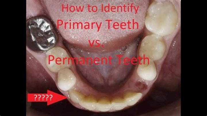Does primary dentition have premolars?