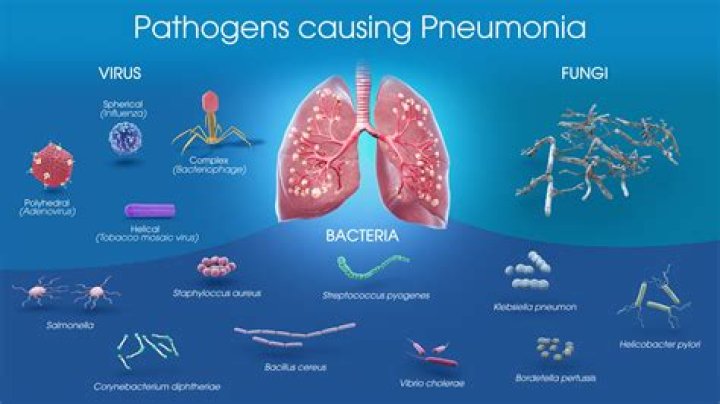 Does protozoa cause pneumonia?