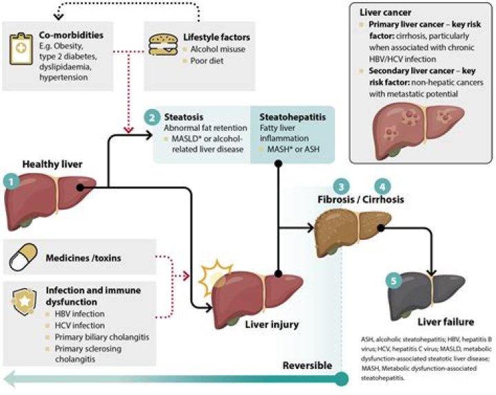 Does ranitidine affect the liver?