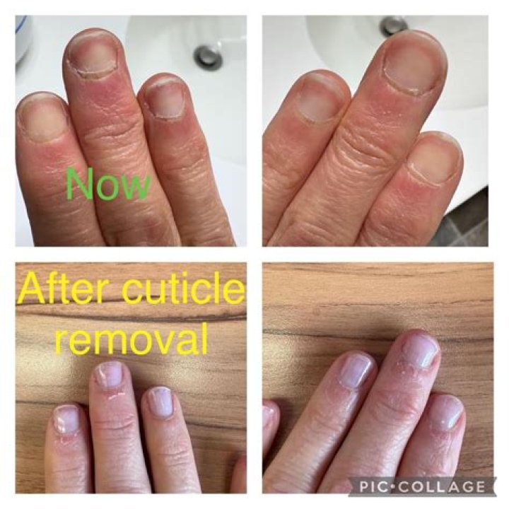 Has a thick cuticle?