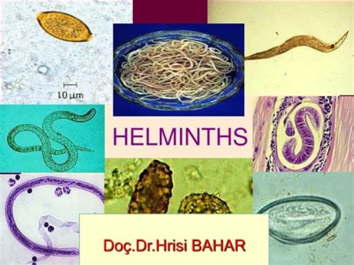 How are helminths contracted?