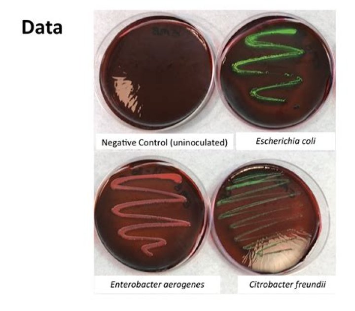 How can the aerobe pseudomonas aeruginosa?