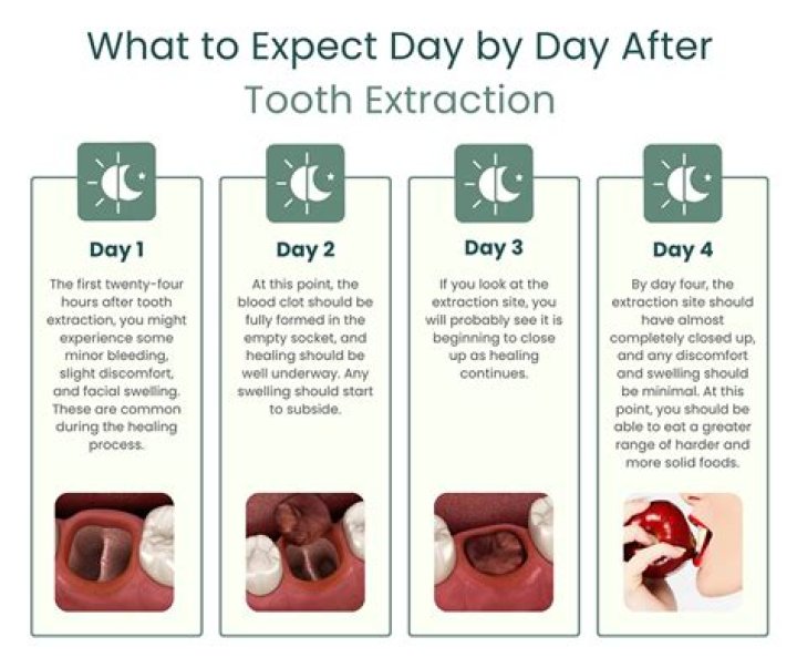 How long numbness after wisdom tooth extraction?