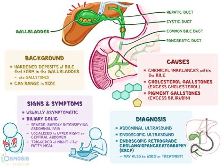 How to diagnose lithiasis?