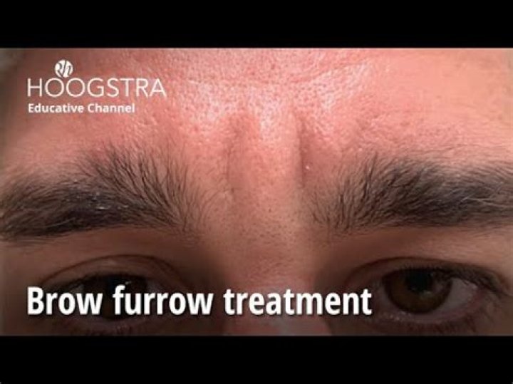 How to furrowed brow?