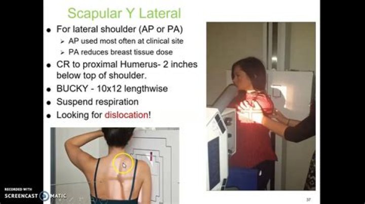 How to get a scapular?