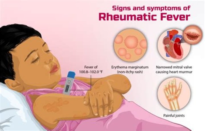 How to get rheumatic fever?