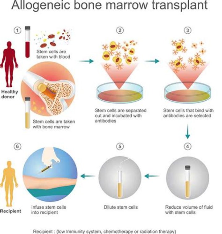 In allogeneic bone marrow transplant patients?
