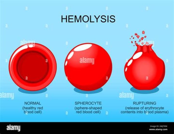 In red blood cell hemolysis?