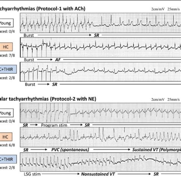 In vivo electrophysiological studies?