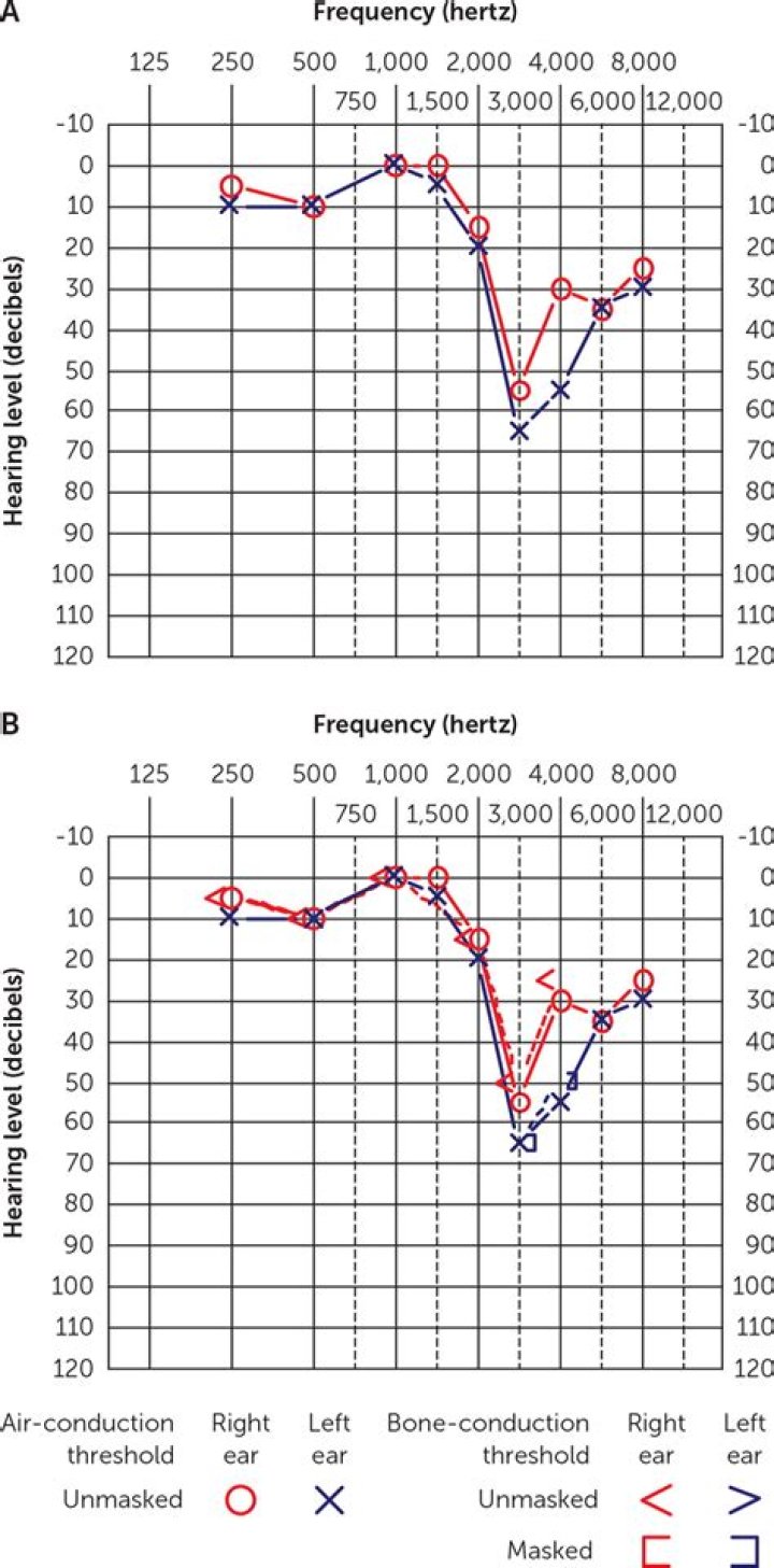 Is audiometry a noun?
