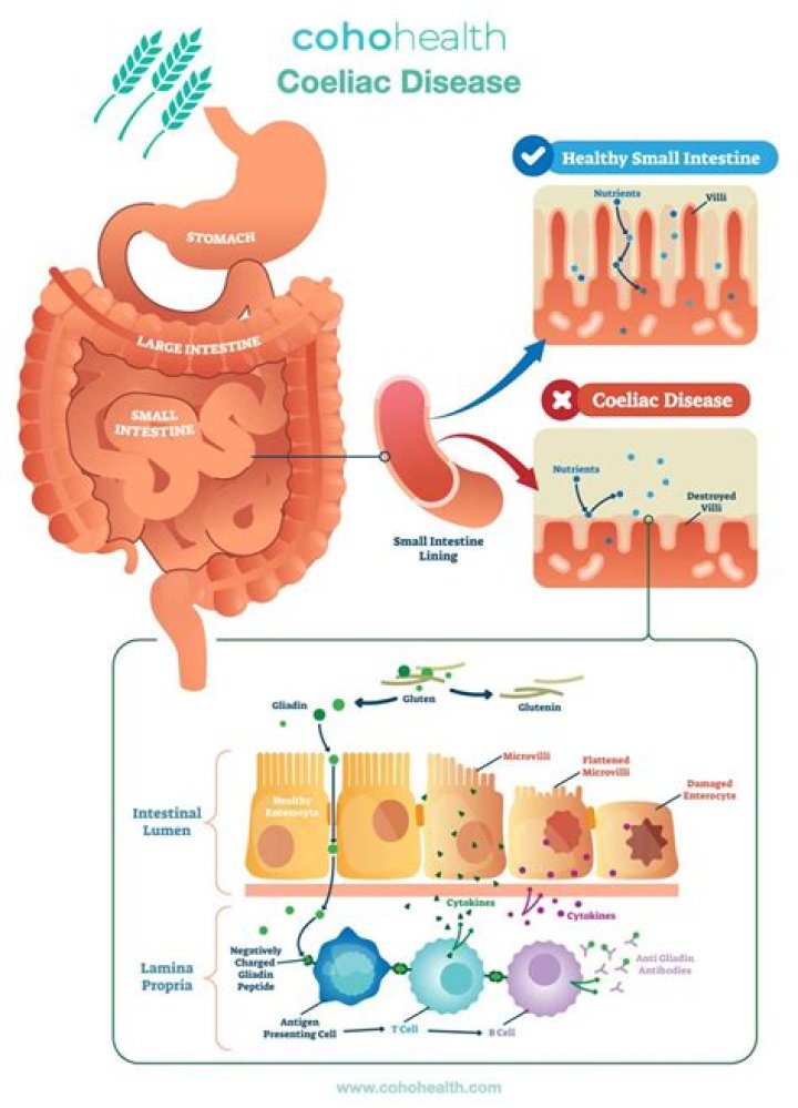 Is coeliac disease a disability?