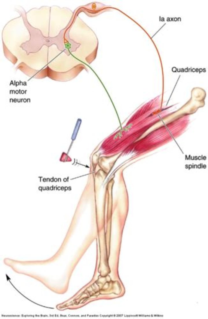 Is deep tendon reflex?