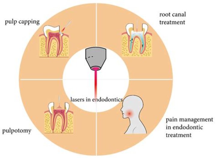 Is endodontics covered by medical insurance?