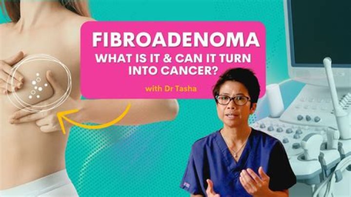 Is fibroadenoma is cancerous?