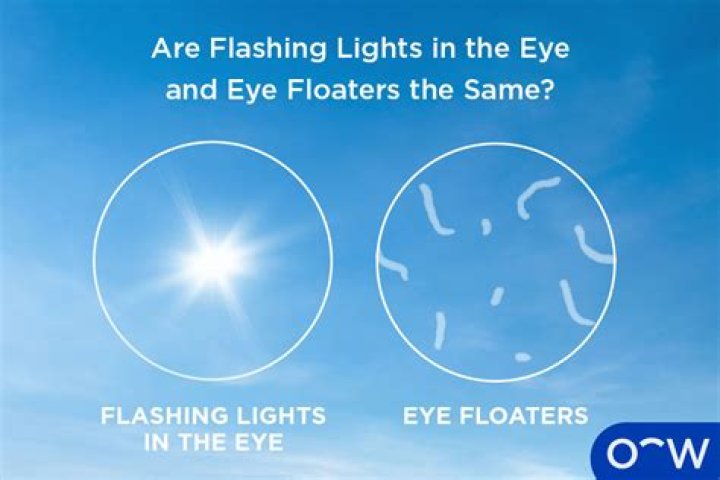 Is it normal to see floaters in bright light?