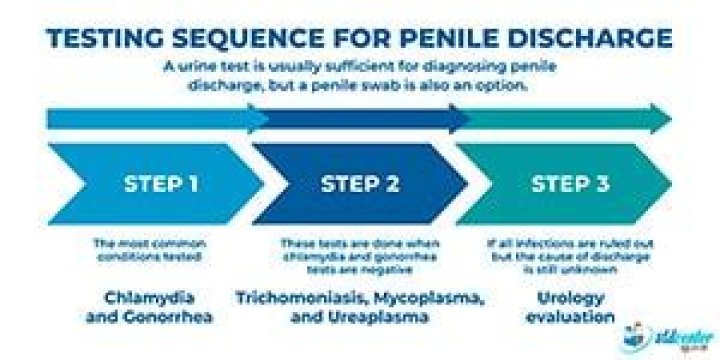 Is penile discharge a sign of hiv?