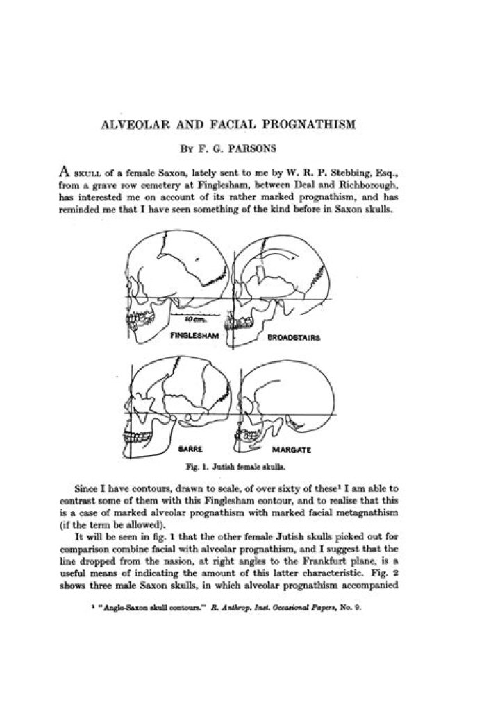 Is there facial prognathism?