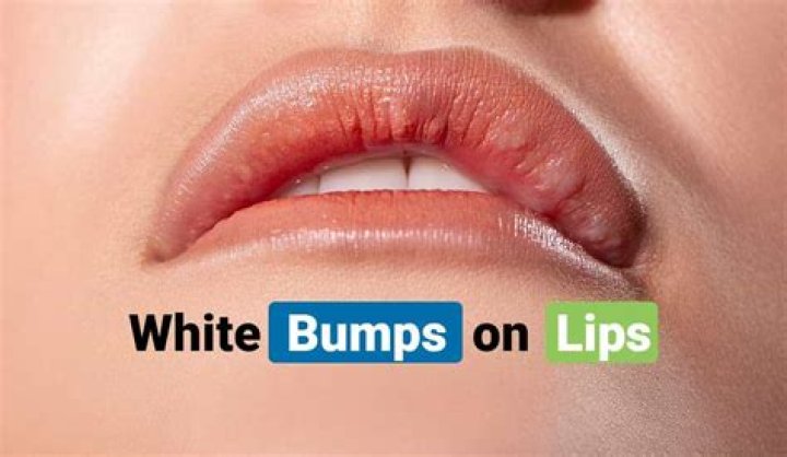 Is white bump on lip?