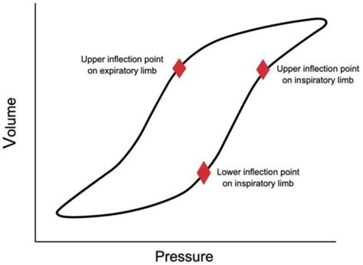 Prove one standard deviation lies on inflection points