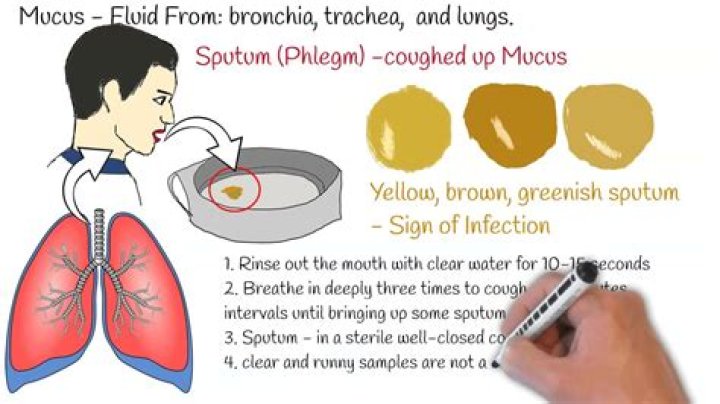 Should i spit out mucus after coughing?